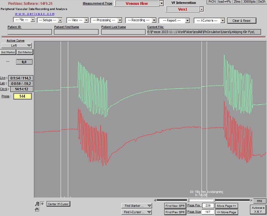 Volume (plethysmographic) data recording